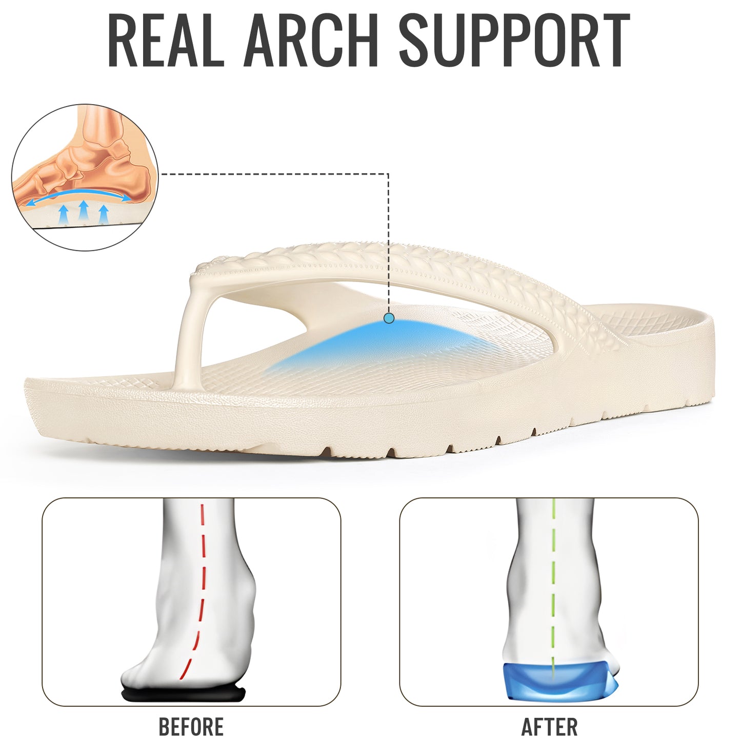 KIDMI Arch Support Flip Flops for Womens Comfortable Orthopedic Sandals for Plantar Fasciitis Beach Thong Slides